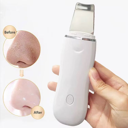 Spatule rechargeable exfoliant peeling visage